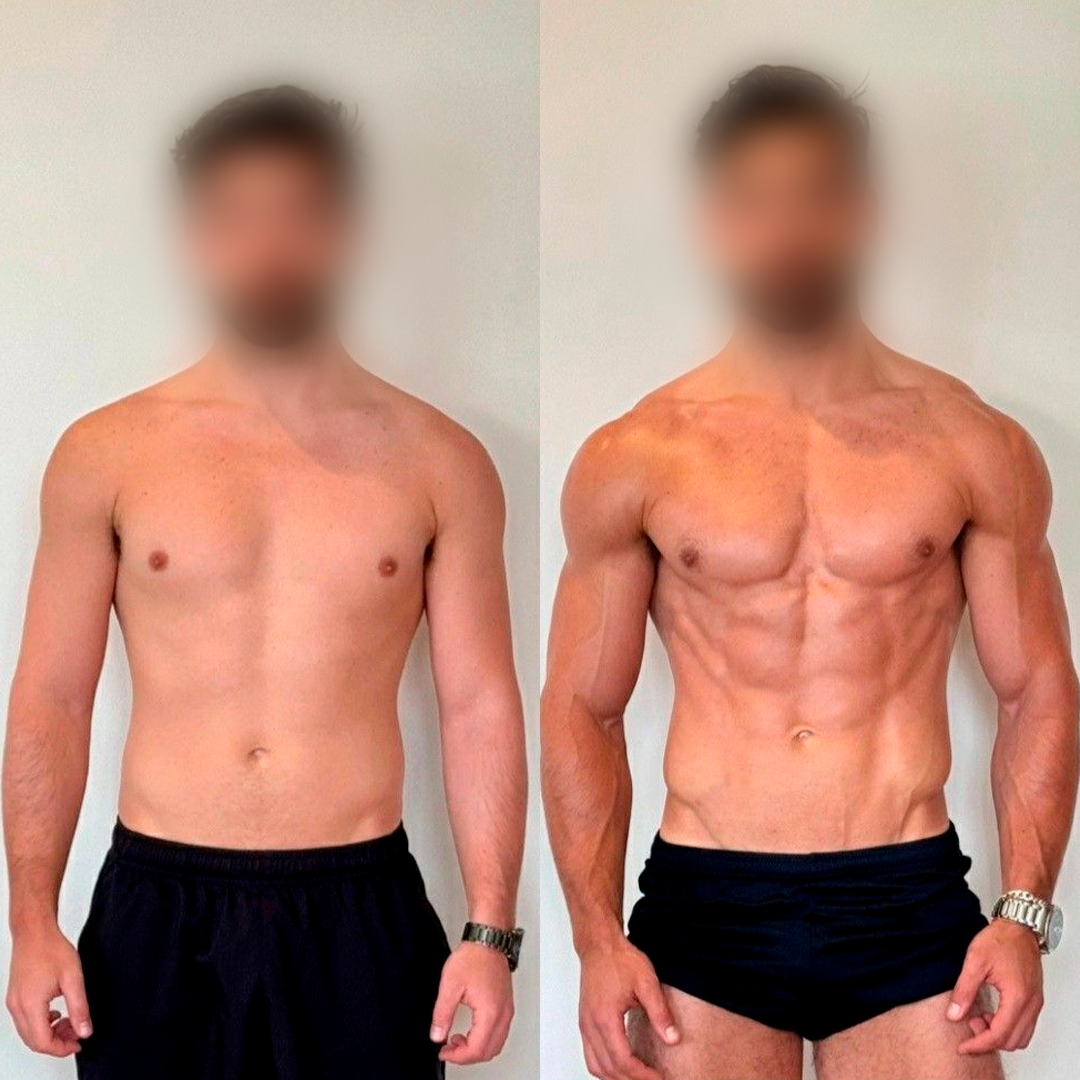 Antes-e-Depois-Genéricos4